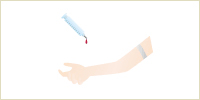 1.採血(15〜20cc)をします